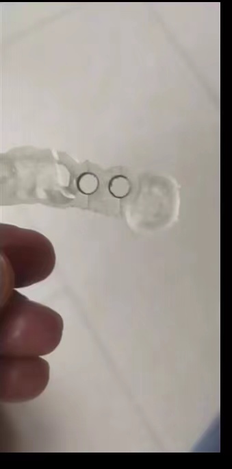 الراتنج الأسنان طابعة ثلاثية ا - مراجعة 3D Printing Guide وسعره
